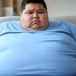 Obesity Obesity