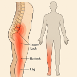 Pain often on one side of the body