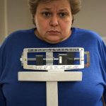 Unexplained weight loss Unexplained weight loss
