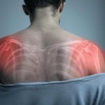inflammation inflammation